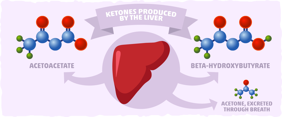 Acetoacetate — The First Ketone Our Body Produces